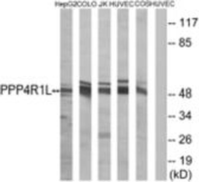 PPP4R1L Antibody in Western Blot (WB)