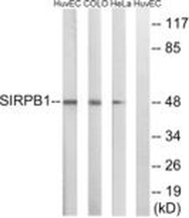 SIRPB1 Antibody in Western Blot (WB)