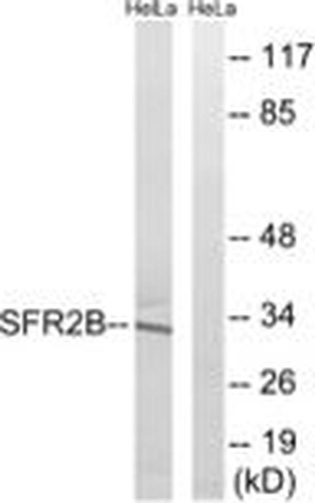 SRSF8 Antibody in Western Blot (WB)