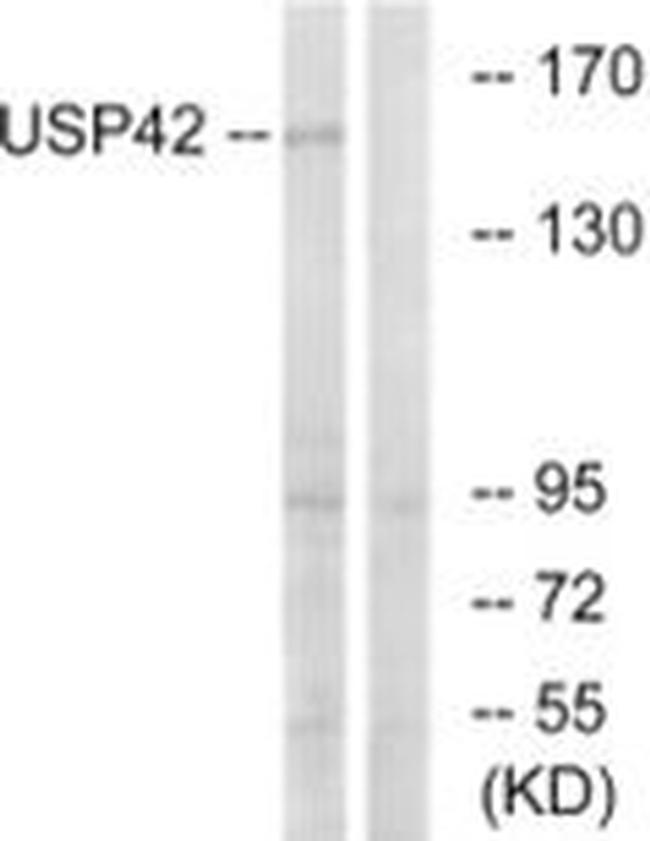 USP42 Antibody in Western Blot (WB)