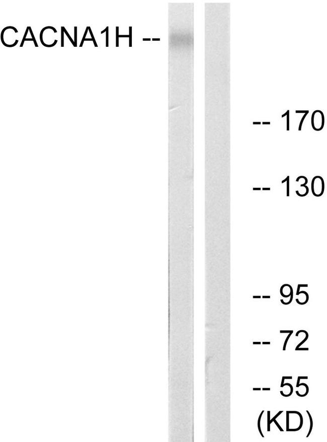 CaV3.2 Antibody in Western Blot (WB)