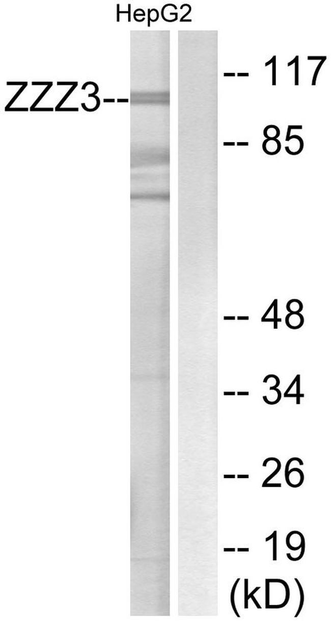 ZZZ3 Antibody in Western Blot (WB)