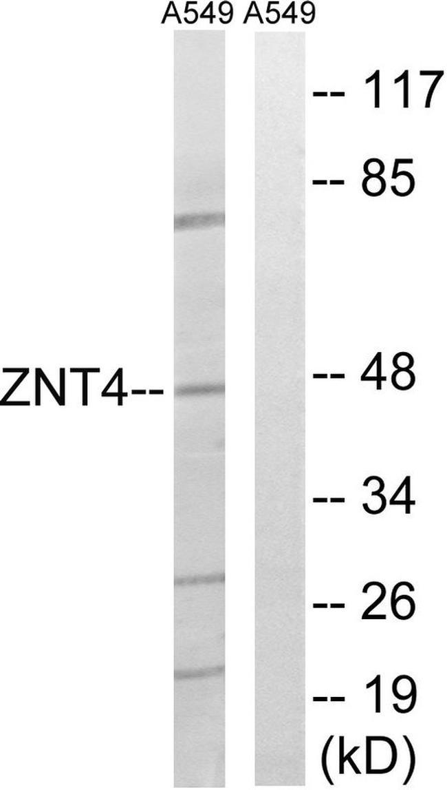 SLC30A4 Antibody in Western Blot (WB)