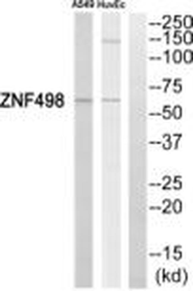 ZNF498 Antibody in Western Blot (WB)