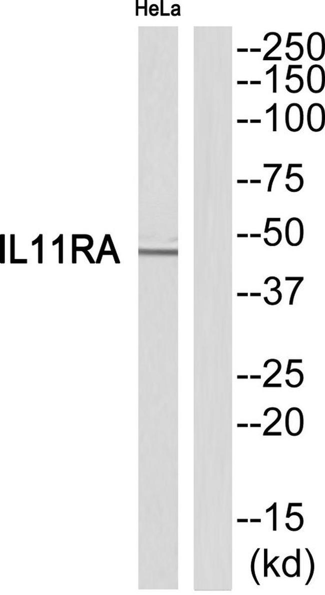 IL11RA Antibody in Western Blot (WB)