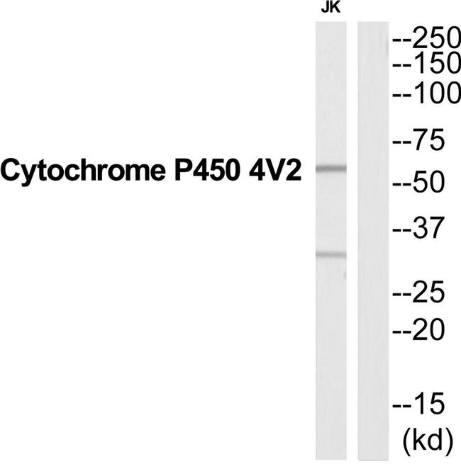 CYP4V2 Antibody in Western Blot (WB)