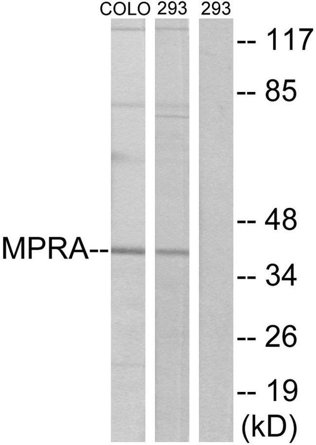 mPR alpha Antibody in Western Blot (WB)