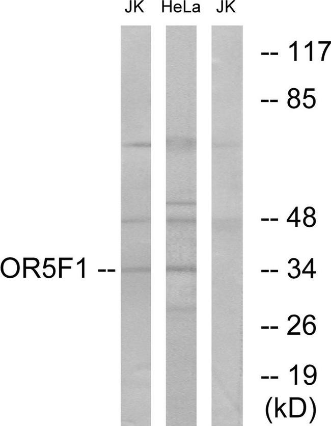 OR5F1 Antibody in Western Blot (WB)