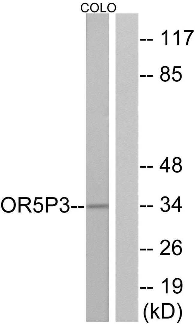 OR5P3 Antibody in Western Blot (WB)