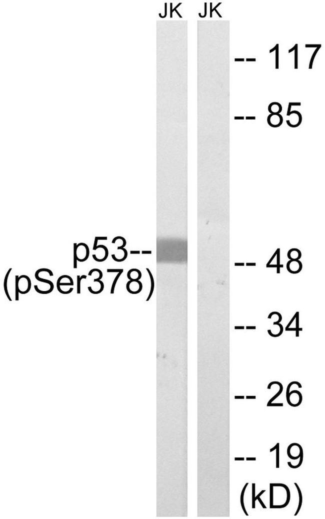 Phospho-p53 (Ser378) Antibody in Western Blot (WB)