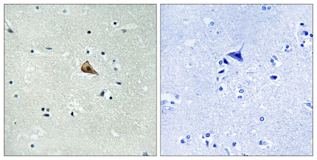 Phospho-TrkA (Tyr701) Antibody in Immunohistochemistry (Paraffin) (IHC (P))