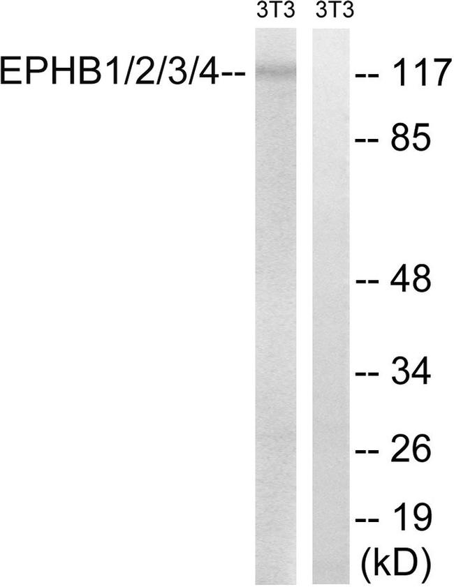 EphB Pan Antibody in Western Blot (WB)