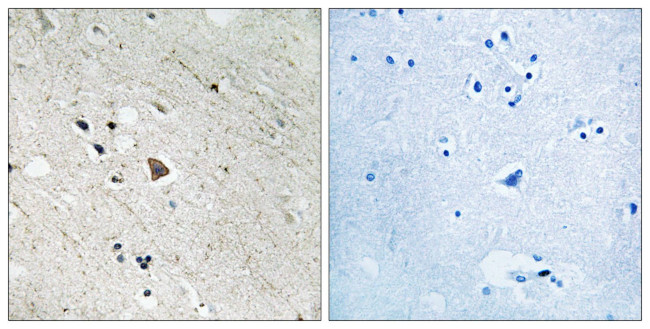 Phospho-FLT3 (Tyr969) Antibody in Immunohistochemistry (Paraffin) (IHC (P))