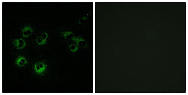 GPR42 Antibody in Immunocytochemistry (ICC/IF)