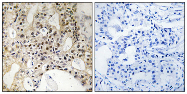 LATS1/LATS2 Antibody in Immunohistochemistry (Paraffin) (IHC (P))