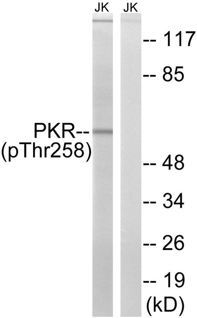 Phospho-PKR (Thr258) Antibody in Western Blot (WB)