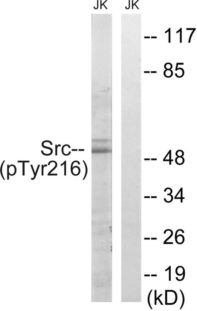 Phospho-SRC (Tyr216) Antibody in Western Blot (WB)