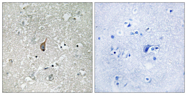 Phospho-APC1 (Ser355) Antibody in Immunohistochemistry (Paraffin) (IHC (P))