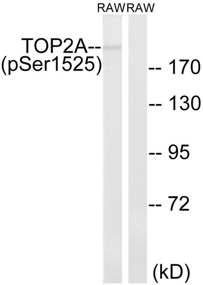 Phospho-TOP2A (Ser1525) Antibody in Western Blot (WB)