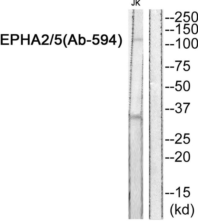 EphA2/EphA5 Antibody in Western Blot (WB)