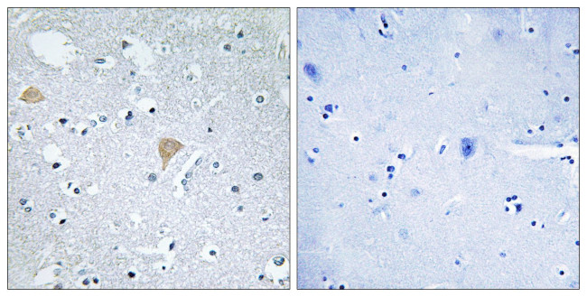 CIT Antibody in Immunohistochemistry (Paraffin) (IHC (P))