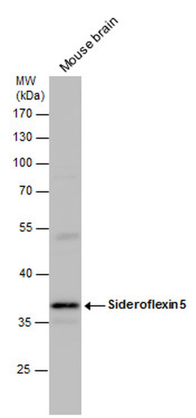 SFXN5 Antibody in Western Blot (WB)