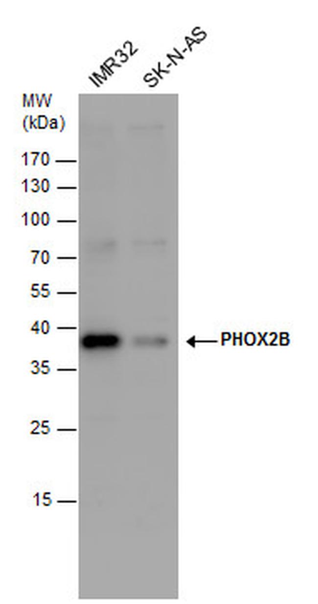 PHOX2B Antibody in Western Blot (WB)