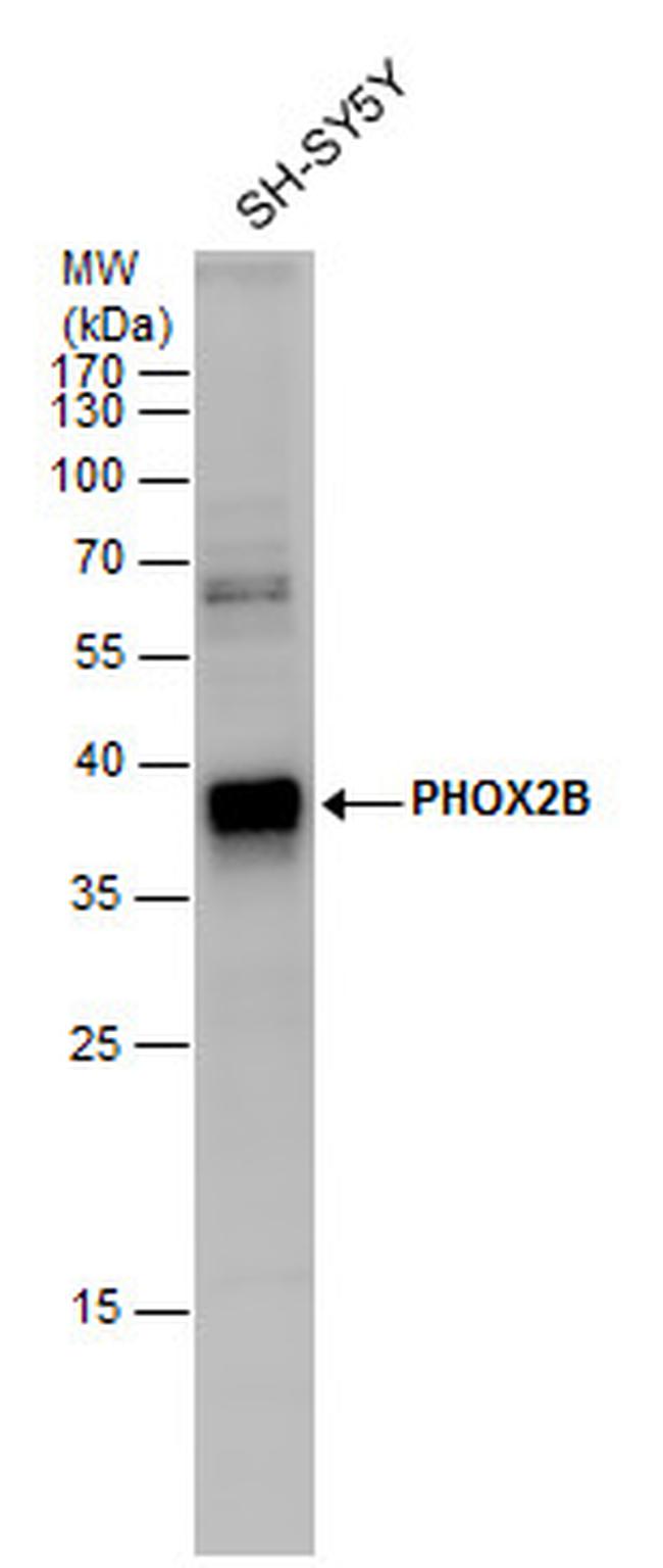 PHOX2B Antibody in Western Blot (WB)