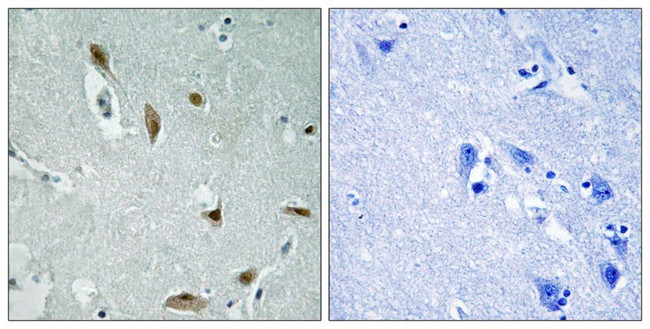 Phospho-AKT1/AKT3 (Tyr437, Tyr434) Antibody in Immunohistochemistry (Paraffin) (IHC (P))