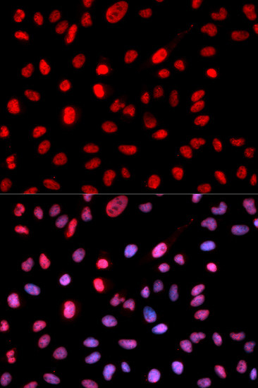 Phospho-DNMT1 (Ser714) Antibody in Immunocytochemistry (ICC/IF)