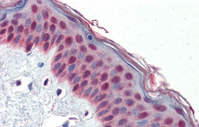 TCF7L1 Antibody in Immunohistochemistry (IHC)