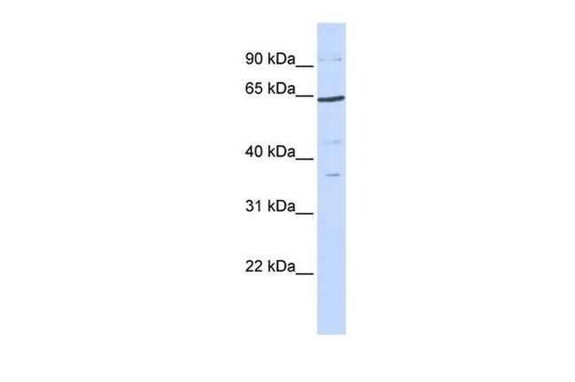 TCF7L1 Antibody in Western Blot (WB)