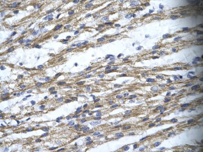 RBM10 Antibody in Immunohistochemistry (Paraffin) (IHC (P))