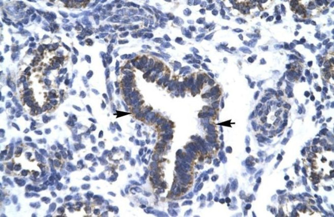 RBM10 Antibody in Immunohistochemistry (Paraffin) (IHC (P))