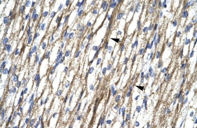 RBM10 Antibody in Immunohistochemistry (Paraffin) (IHC (P))