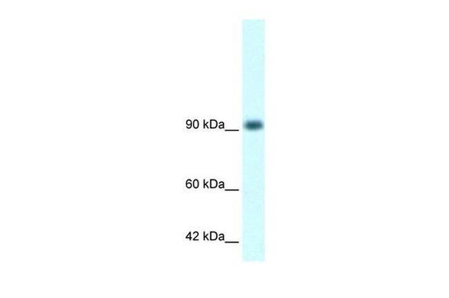 RBM10 Antibody in Western Blot (WB)