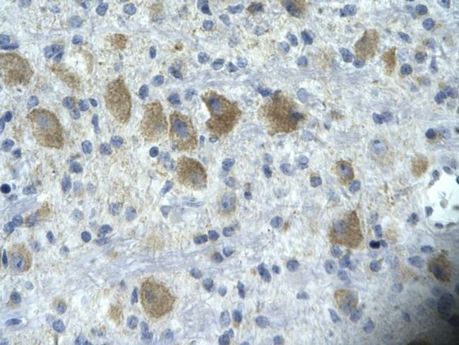 TAF15 Antibody in Immunohistochemistry (Paraffin) (IHC (P))