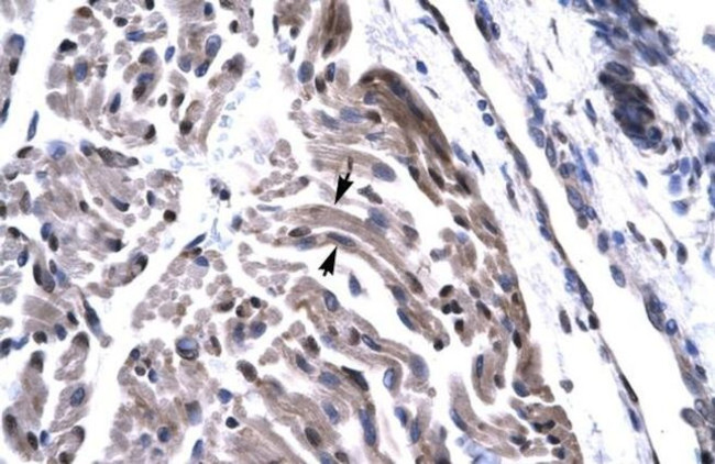 TAF15 Antibody in Immunohistochemistry (Paraffin) (IHC (P))