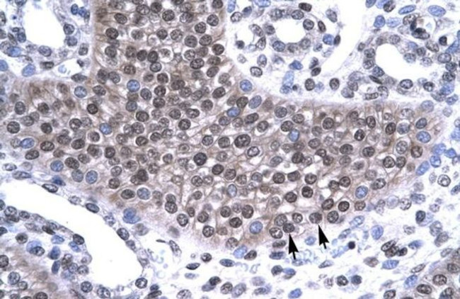 TAF15 Antibody in Immunohistochemistry (Paraffin) (IHC (P))