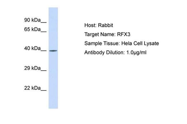 RFX3 Antibody in Western Blot (WB)