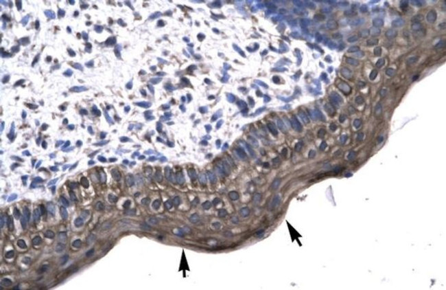 KIN Antibody in Immunohistochemistry (IHC)