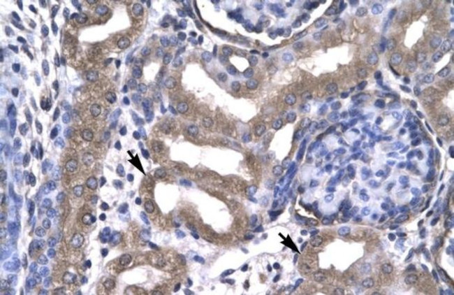 KIN Antibody in Immunohistochemistry (IHC)