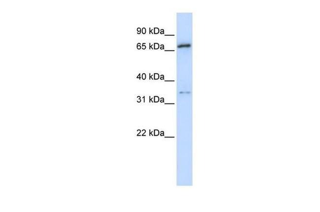 TRIM23 Antibody in Western Blot (WB)