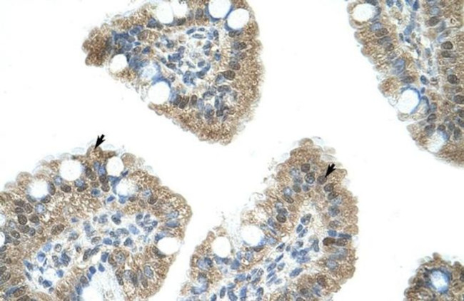 NAB1 Antibody in Immunohistochemistry (IHC)