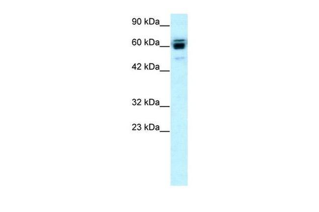 RNF12 Antibody in Western Blot (WB)