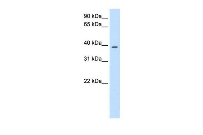 PSMD6 Antibody in Western Blot (WB)