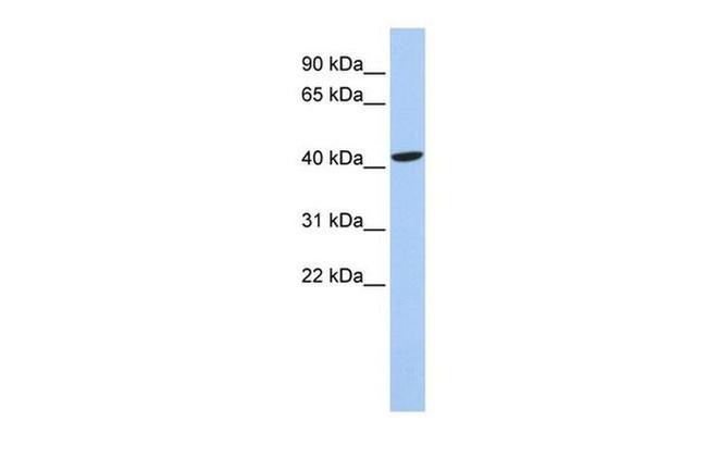 LHX4 Antibody in Western Blot (WB)