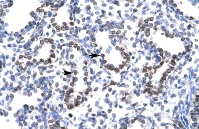 HEY1 Antibody in Immunohistochemistry (Paraffin) (IHC (P))