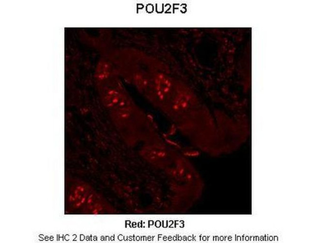 PLA1 Antibody in Immunohistochemistry (IHC)