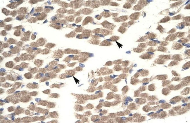 PLA1 Antibody in Immunohistochemistry (IHC)